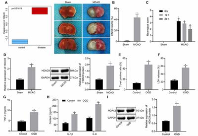 HDAC9 Silencing Exerts Neuroprotection Against Ischemic Brain Injury via miR-20a-Dependent Downregulation of NeuroD1